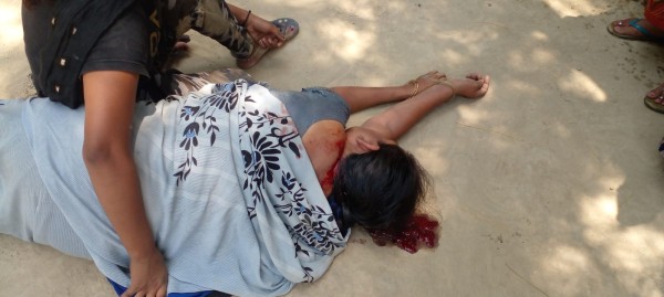 मनमफ़िक सामान न बाँटने पर आगनबाड़ी कर्त्री का सिर फोड़ा , एसओ  ने तहरीर बदलवायी ! हेडइंजरी होने पर भी मेडिकल तक नहीं कराया :PRAYAGRAJ